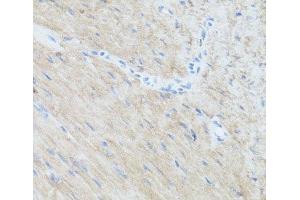 Immunohistochemistry of paraffin-embedded Mouse heart using CLUH Polyclonal Antibody at dilution of 1:100 (40x lens). (CLUH antibody)