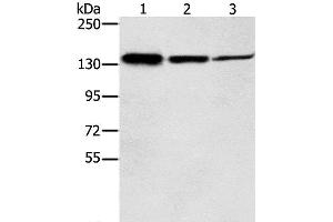 Western Blot analysis of Jurkat, A172 and A549 cell using SMC2 Polyclonal Antibody at dilution of 1:300 (SMC2 antibody)