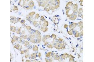 Immunohistochemistry of paraffin-embedded Human stomach using L2HGDH Polyclonal Antibody at dilution of 1:100 (40x lens). (L2HGDH antibody)