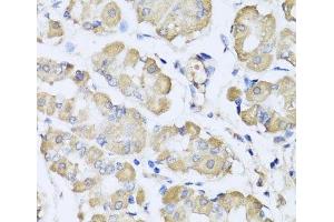 Immunohistochemistry of paraffin-embedded Human stomach using L2HGDH Polyclonal Antibody at dilution of 1:100 (40x lens). (L2HGDH antibody)