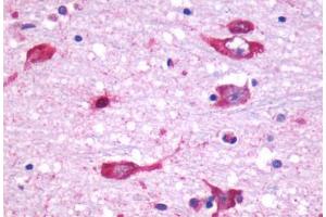 Anti-CHRM5 antibody  ABIN1048445 IHC staining of human brain, neurons and glia. (CHRM5 antibody  (Cytoplasmic Domain))