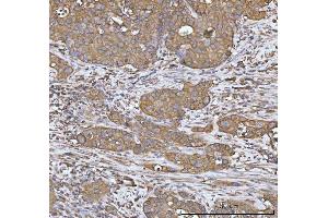 IHC analysis of Heme oxygenase 2/HMOX2 using anti-Heme oxygenase 2/HMOX2 antibody (ABIN7601766).