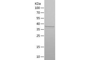 Western Blotting (WB) image for Twist Homolog 1 (Drosophila) (TWIST1) (AA 1-103) protein (His-IF2DI Tag) (ABIN7125567) (TWIST1 Protein (AA 1-103) (His-IF2DI Tag))