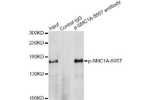 Immunoprecipitation analysis of 200 μg extracts of HeLa cells treated by UV using 2. (SMC1A antibody  (pSer957))