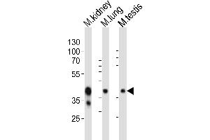 Western blot analysis of lysates from mouse kidney, mouse lung, mouse testis tissue lysate (from left to right), using Epcam Antibody (C-term) (ABIN6242230 and ABIN6577881). (EpCAM antibody  (C-Term))