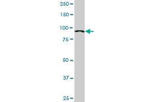 ACTN4 monoclonal antibody (M01), clone 4D10. (alpha Actinin 4 antibody  (AA 592-701))