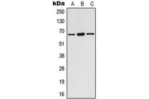 Western blot analysis of Estrogen Receptor alpha (pY537) expression in HeLa (A), SP2/0 (B), rat spleen (C) whole cell lysates. (Estrogen Receptor alpha antibody  (C-Term, pTyr537))