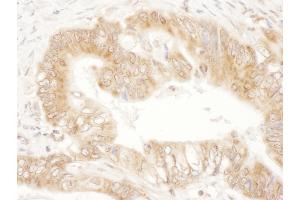 anti-Calcium/calmodulin-Dependent Protein Kinase Kinase 2, beta (CAMKK2) (AA 538-588) antibody