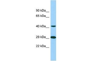 Western Blotting (WB) image for anti-Tubulin tyrosine Ligase-Like Family, Member 1 (TTLL1) (C-Term) antibody (ABIN2789136) (TTLL1 antibody  (C-Term))