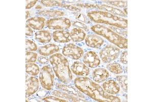 Immunohistochemistry of paraffin-embedded mouse kidney using MK4 Rabbit mAb (ABIN7268653) at dilution of 1:50 (40x lens). (MAP3K4 antibody)