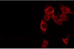 ABIN6266593 staining HepG2 by IF/ICC. (MMP16 antibody  (C-Term))