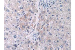 Used in DAB staining on fromalin fixed paraffin- embedded liver cancer tissue