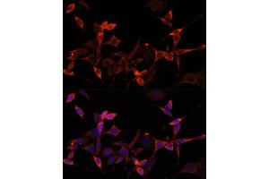 Immunofluorescence analysis of NIH-3T3 cells using S1/PR Polyclonal Antibody (ABIN6129890, ABIN6136741, ABIN6136742 and ABIN6221835) at dilution of 1:100 (40x lens). (PRAS40 antibody  (AA 152-276))