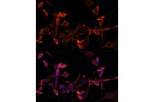 Immunofluorescence analysis of NIH-3T3 cells using S1/PR Polyclonal Antibody (ABIN6129890, ABIN6136741, ABIN6136742 and ABIN6221835) at dilution of 1:100 (40x lens). (PRAS40 antibody  (AA 152-276))