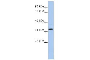 WB Suggested Anti-C15orf26 Antibody Titration: 0. (C15orf26/CFAP161 antibody  (C-Term))