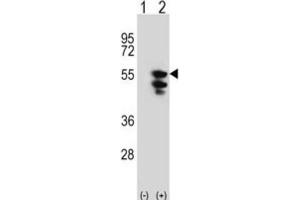 Western Blotting (WB) image for anti-Tu Translation Elongation Factor, Mitochondrial (Tufm) antibody (ABIN3001714) (TUFM antibody)
