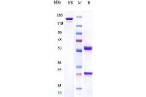 Anti-C1q Reference Antibody (ANX005) on SDS-PAGE under reducing (R) condition.