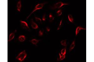 ABIN6267276 staining 293 by IF/ICC. (Estrogen Receptor alpha antibody  (pSer104))