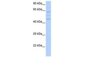 Image no. 1 for anti-Vacuolar Protein Sorting 37 Homolog A (VPS37A) (N-Term) antibody (ABIN6741204) (VPS37A antibody  (N-Term))