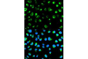 Immunofluorescence analysis of MCF-7 cells using GYPC antibody (ABIN5970574). (CD236/GYPC antibody)