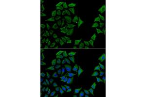 Immunofluorescence analysis of U2OS cells using TCN1 antibody. (TCN1 antibody)