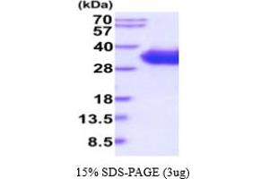 CD2 (CD2) (AA 25-209) protein (His tag)