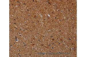 Immunohistochemistry of Human brain  using CYP1A2 Polyclonal Antibody at dilution of 1:40
