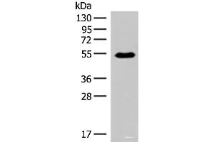 Western blot analysis of Human fetal brain tissue lysate using HTR2A Polyclonal Antibody at dilution of 1:200 (HTR2A antibody)