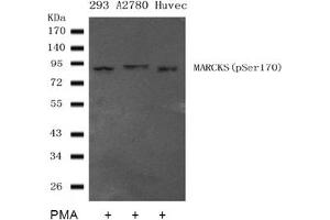 Image no. 2 for anti-Myristoylated Alanine-Rich Protein Kinase C Substrate (MARCKS) (pSer170) antibody (ABIN401559) (MARCKS antibody  (pSer170))