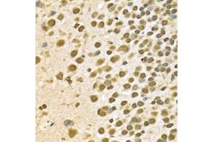 Immunohistochemistry (IHC) image for anti-Heterogeneous Nuclear Ribonucleoprotein A2/B1 (HNRNPA2B1) (AA 1-180) antibody (ABIN3021593)
