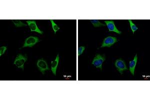 ICC/IF Image Pyruvate Kinase (liver/RBC) antibody detects Pyruvate Kinase (liver/RBC) protein at cytoplasm by immunofluorescent analysis. (Pyruvate Kinase antibody  (Center))