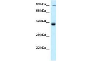 Image no. 1 for anti-T-Cell Activation rho GTPase-Activating Protein (TAGAP) (AA 202-251) antibody (ABIN6747648) (TAGAP antibody  (AA 202-251))