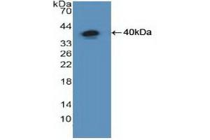 Detection of Recombinant NFkB, Human using Polyclonal Antibody to Nuclear Factor Kappa B (NFkB) (NFkB antibody  (AA 805-892))