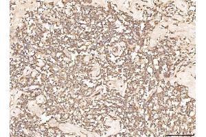 IHC analysis of BHMT using anti-BHMT antibody (ABIN7599940). (BHMT antibody  (AA 13-386))