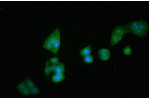 Immunofluorescent analysis of PC-3 cells using ABIN6953148 at dilution of 1:100 and Alexa Fluor 488-congugated AffiniPure Goat Anti-Rabbit IgG(H+L) (DPP4 antibody  (AA 473-588))