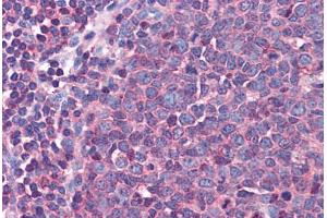 Human Tonsil: Formalin-Fixed, Paraffin-Embedded (FFPE) (Actin, gamma 1 antibody  (AA 1-119))