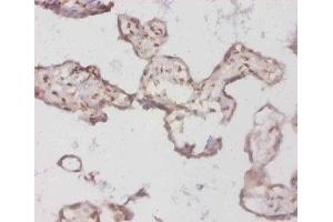 Immunohistochemistry of paraffin-embedded human placenta tissue using ABIN7145688 at dilution of 1:50 (BMP3 antibody  (AA 362-472))