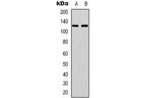 Western blot analysis of EPHA4 (pY596) expression in HUVEC (A), Hela (B) whole cell lysates. (EPH Receptor A4 antibody  (pTyr596))
