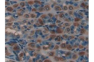 Immunohistochemistry (IHC) image for anti-serpin Peptidase Inhibitor, Clade D (Heparin Cofactor), Member 1 (SERPIND1) (AA 25-235) antibody (ABIN7431518)