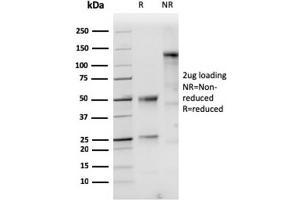 SDS-PAGE Analysis of Purified Cytokeratin 10 Rabbit Recombinant Monoclonal Antibody (KRT10/1948R). (Recombinant Keratin 10 antibody)