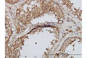 Image no. 1 for anti-phosphoinositide Kinase, FYVE Finger Containing (PIKFYVE) (AA 342-452) antibody (ABIN599337) (PIKFYVE antibody  (AA 342-452))
