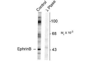 Image no. 1 for anti-Ephrin B1 (EFNB1) (pTyr317) antibody (ABIN372620) (Ephrin B1 antibody  (pTyr317))