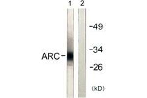 Western blot analysis of extracts from HeLa cells, using ARC Antibody. (ARC (AA 159-208) antibody)