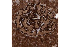 Immunohistochemical staining of human pancreas with SEMA3G polyclonal antibody  shows strong cytoplasmic positivity in exocrine glandular cells and islet cells at 1:200-1:500 dilution. (SEMA3G antibody)