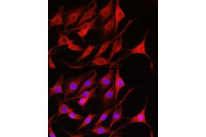 Immunofluorescence analysis of NIH-3T3 cells using Rac1/2/3 Rabbit pAb (ABIN6129317, ABIN6146616, ABIN6146618 and ABIN6223653) at dilution of 1:100 (40x lens). (RAC1 antibody  (AA 1-192))