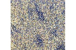 IHC analysis of CD79b using anti-CD79b antibody (ABIN3043398).
