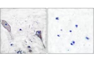 Immunohistochemistry analysis of paraffin-embedded human brain tissue, using Patched Antibody. (Patched 1 antibody  (AA 1-50))