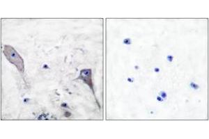 Immunohistochemistry analysis of paraffin-embedded human brain tissue, using Patched Antibody.