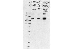 RSMC cells (STIM1 antibody  (Middle Region))