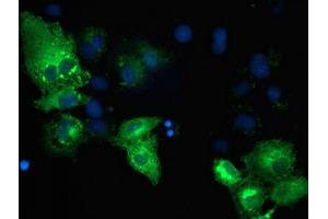 Anti-TBC1D4 mouse monoclonal antibody (ABIN2454446) immunofluorescent staining of COS7 cells transiently transfected by pCMV6-ENTRY TBC1D4 (RC212105). (TBC1D4 antibody)